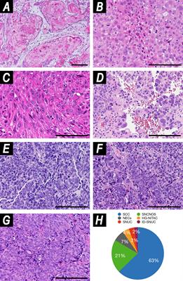 Does Reorganization of Clinicopathological Information Improve Prognostic Stratification and Prediction of Chemoradiosensitivity in Sinonasal Carcinomas? A Retrospective Study on 145 Patients